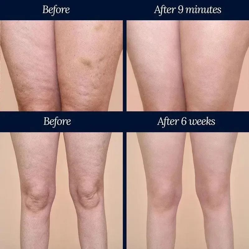 Legtone Serum - Image 4