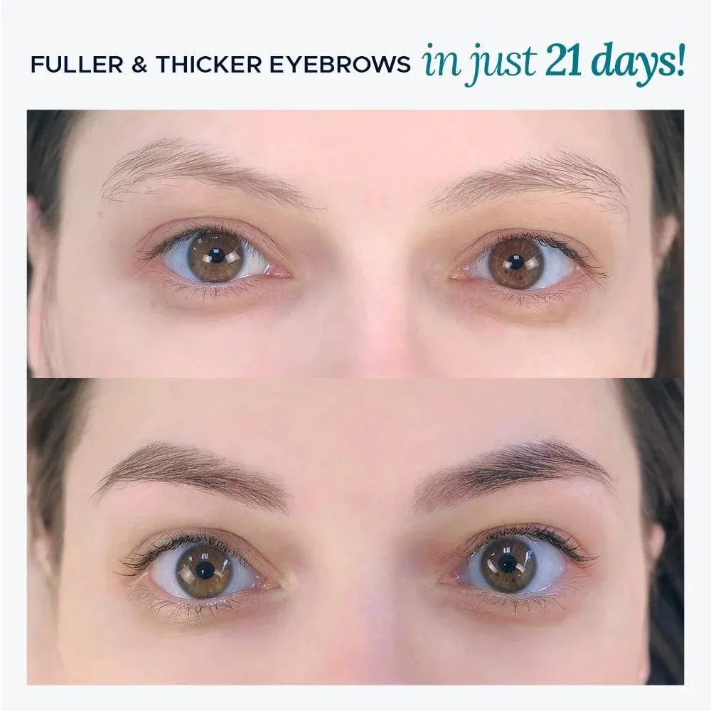 Brow Revive - Image 4