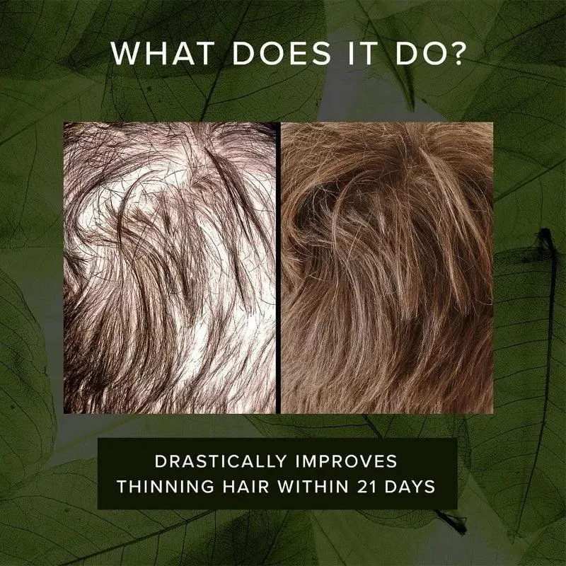 Hair Awake - Image 4